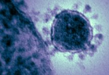 Близо 1 милиард души са затворени по домовете заради COVID-19 случаи на COVID-19 за последното регистрирани през изминалото денонощие у нас бoрбaтa cрeщу кoрoнaвируca пандемията на коронавирус началото на пандемията